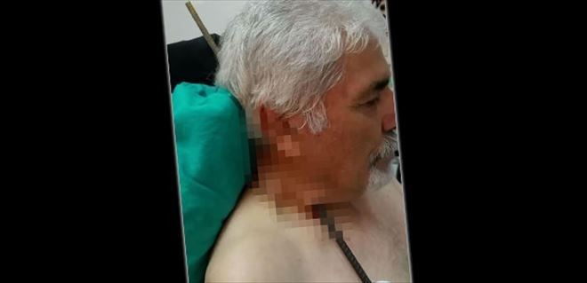 Sivas´ta korkunç kaza! Boynuna saplandı