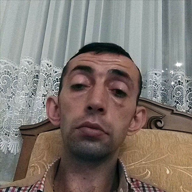 Halk otobüsünün çarptığı bisikletli öldü