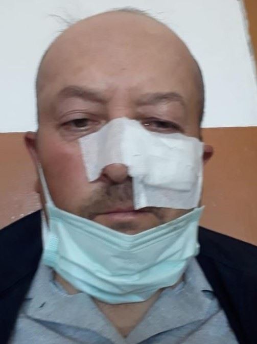 İşçi, İşçi Bayramında darp edildi