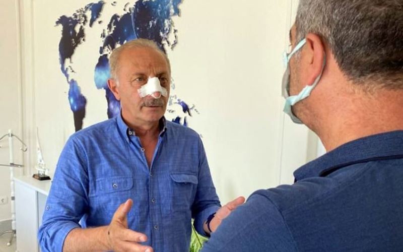 Aydın Didim’de Başkanı Atabay’a saldırı anı görüntüleri yayınlandı