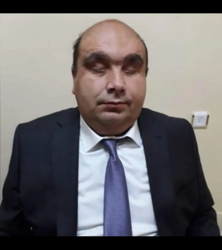 Devecioğlu’ndan Engelliler Günü açıklaması 